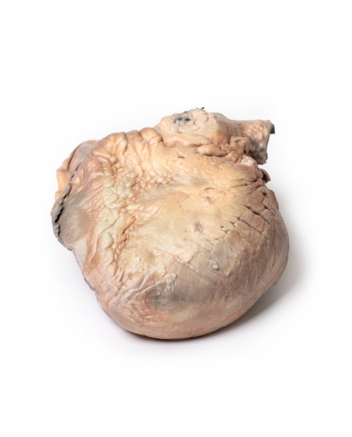 Aneurisma dell aorta toracica rotto Erler Zimmer 3D anatomy Series MP2043