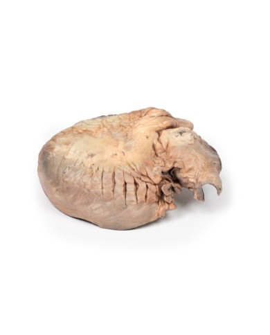 Aneurisma dell aorta toracica rotto Erler Zimmer 3D anatomy Series MP2043