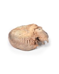 Aneurisma dell aorta toracica rotto Erler Zimmer 3D anatomy Series MP2043