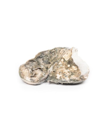 Tubercolosi fibro caseosa Erler Zimmer 3D anatomy Series MP2054