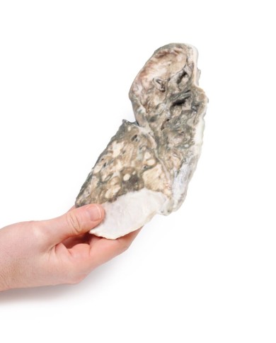 Tubercolosi fibro caseosa Erler Zimmer 3D anatomy Series MP2054