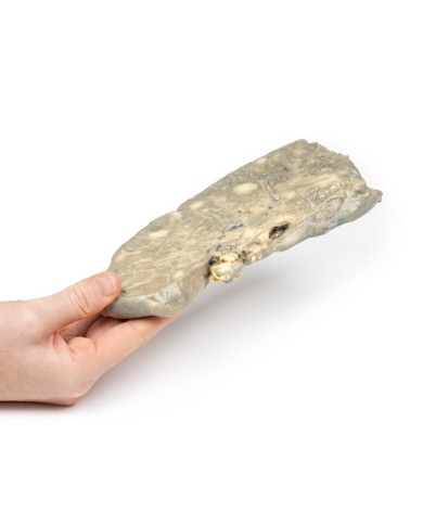 Carcinoma metastatico nel polmone Erler Zimmer 3D anatomy Series MP2056