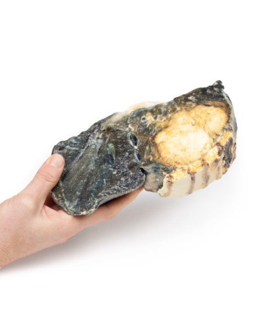 Tumore metastatico nel polmone da cancro testicolare primario Erler Zimme