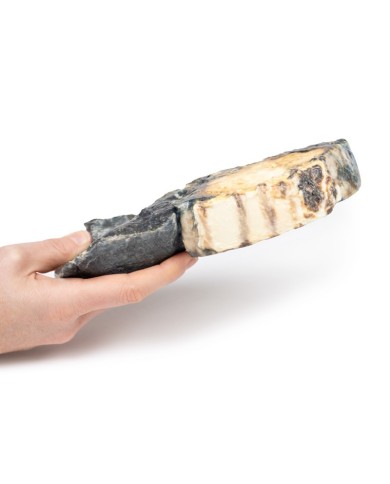 Tumore metastatico nel polmone da cancro testicolare primario Erler Zimme