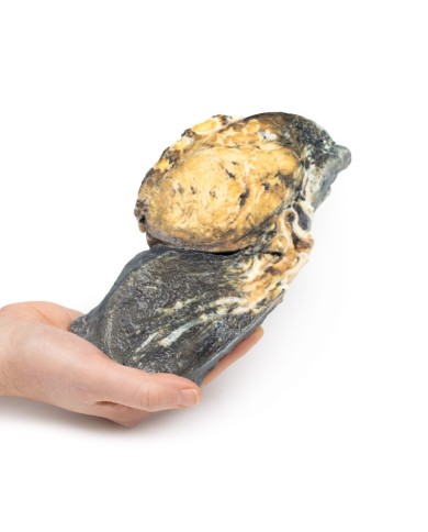 Tumore metastatico nel polmone da cancro testicolare primario Erler Zimme