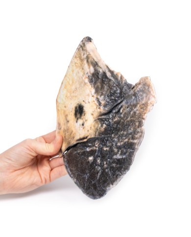 Polmonite lobare Erler Zimmer 3D anatomy Series MP2057