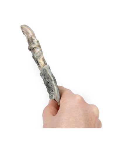 Fistola tracheoesofagea e atresia esofagea Erler Zimmer 3D anatomy Series