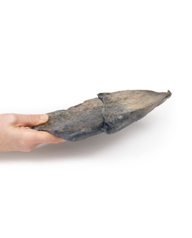 Broncopolmonite Erler Zimmer 3D anatomy Series MP2058