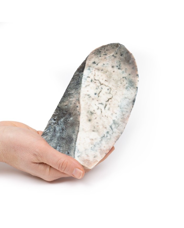 Polmonite lobare Fase di epatizzazione grigia Erler Zimmer 3D anatomy S