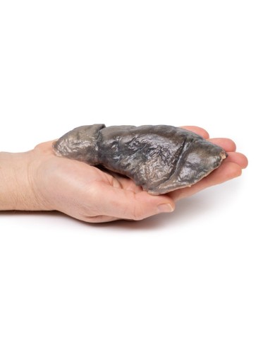 Polmone fibrosi cistica Erler Zimmer 3D anatomy Series MP2063