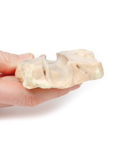 Trachea linfoma di Hodgkin Erler Zimmer 3D anatomy Series MP2062