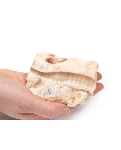 Trachea linfoma di Hodgkin Erler Zimmer 3D anatomy Series MP2062