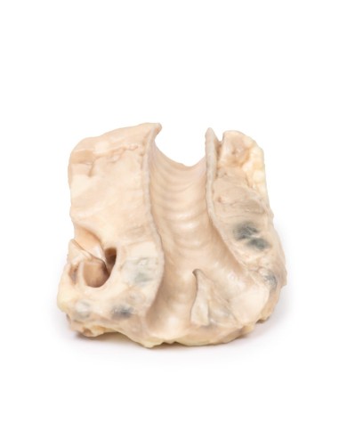 Trachea linfoma di Hodgkin Erler Zimmer 3D anatomy Series MP2062