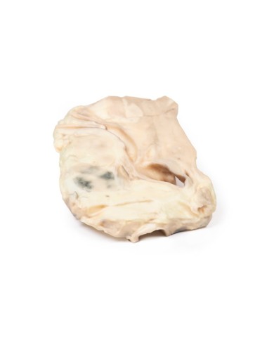 Trachea linfoma di Hodgkin Erler Zimmer 3D anatomy Series MP2062