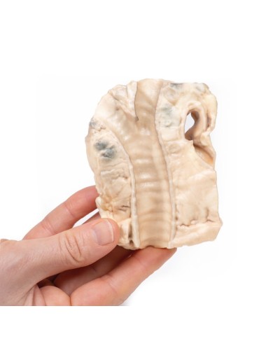 Trachea linfoma di Hodgkin Erler Zimmer 3D anatomy Series MP2062