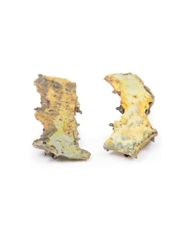 Poliposi multipla Erler Zimmer 3D anatomy Series MP2070