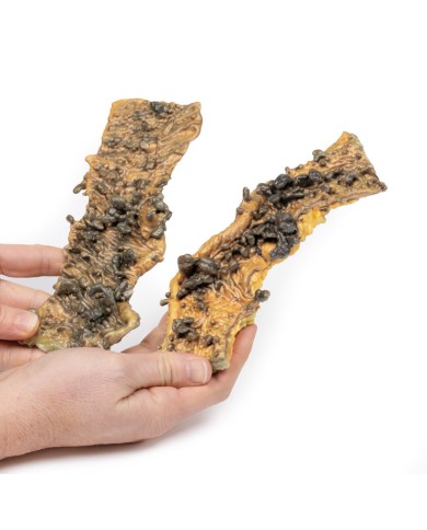 Poliposi multipla Erler Zimmer 3D anatomy Series MP2070