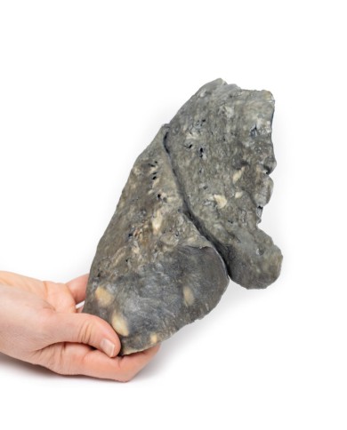 Polmone depositi multipli di carcinoma secondario nel polmone e nella pleu