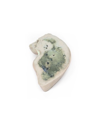 Fegato grasso Erler Zimmer 3D anatomy Series MP2072