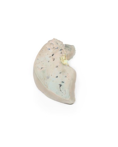 Fegato grasso Erler Zimmer 3D anatomy Series MP2072