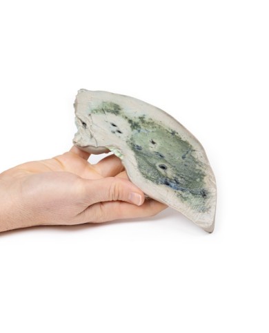 Fegato grasso Erler Zimmer 3D anatomy Series MP2072