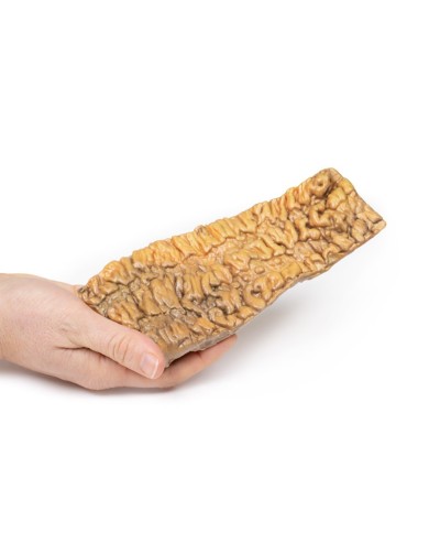 Colite ulcerosa Erler Zimmer 3D anatomy Series MP2074