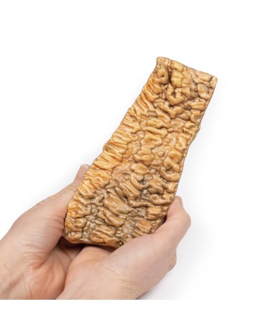 Colite ulcerosa Erler Zimmer 3D anatomy Series MP2074