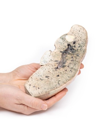 Cirrosi epatica Erler Zimmer 3D anatomy Series MP2073