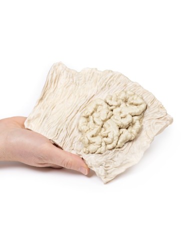 Adenoma villoso del colon Erler Zimmer 3D anatomy Series MP2071