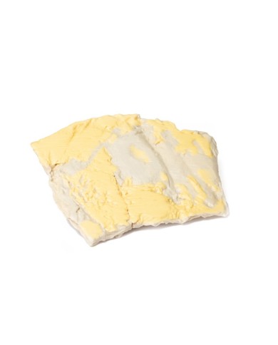 Adenoma villoso del colon Erler Zimmer 3D anatomy Series MP2071