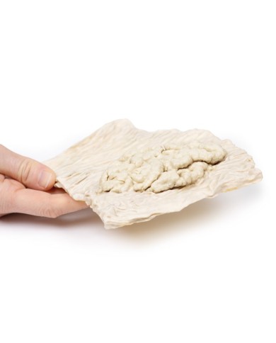 Adenoma villoso del colon Erler Zimmer 3D anatomy Series MP2071