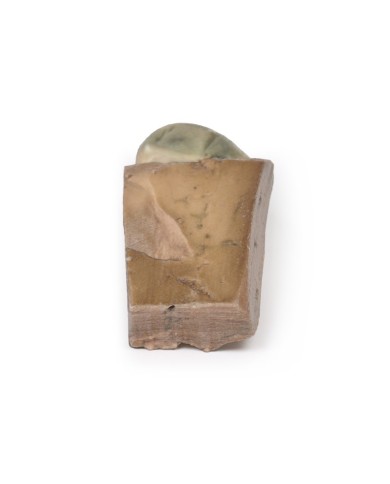 Colelitiasi calcoli biliari Erler Zimmer 3D anatomy Series MP2075