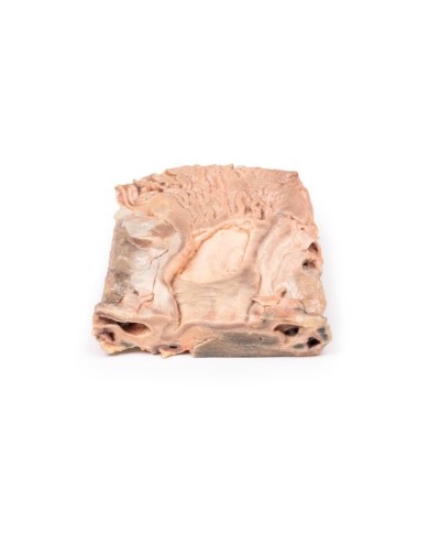 Ulcere gastriche croniche Erler Zimmer 3D anatomy Series MP2076