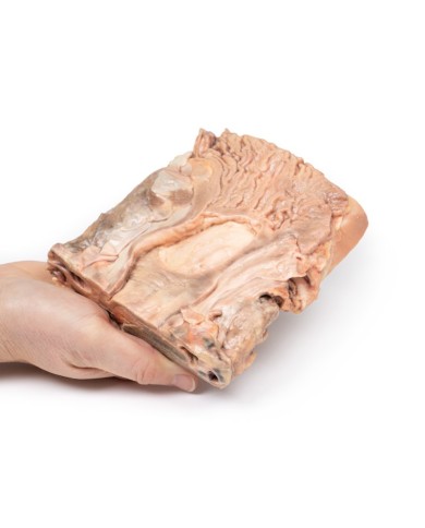 Ulcere gastriche croniche Erler Zimmer 3D anatomy Series MP2076