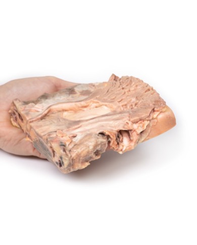 Ulcere gastriche croniche Erler Zimmer 3D anatomy Series MP2076