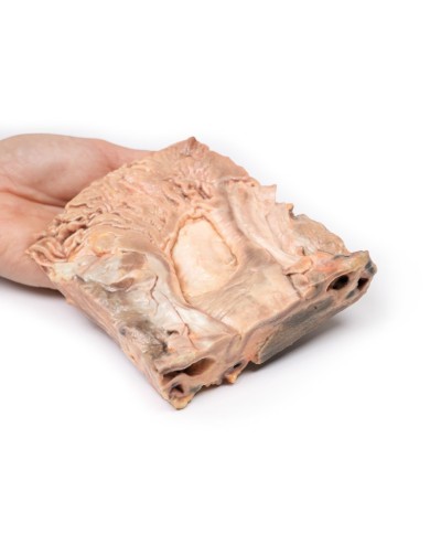 Ulcere gastriche croniche Erler Zimmer 3D anatomy Series MP2076