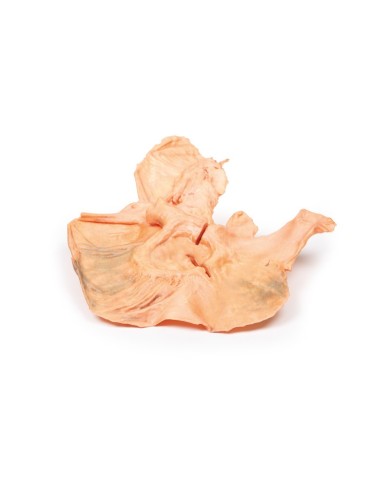 Adenocarcinoma dello stomaco Erler Zimmer 3D anatomy Series MP2080