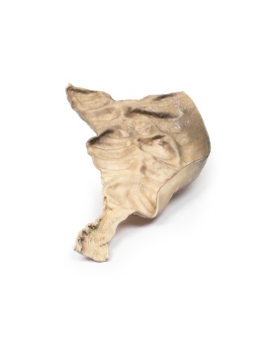 Malattia di Hirschsprung Erler Zimmer 3D anatomy Series MP2079