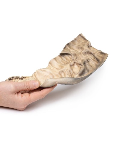 Malattia di Hirschsprung Erler Zimmer 3D anatomy Series MP2079