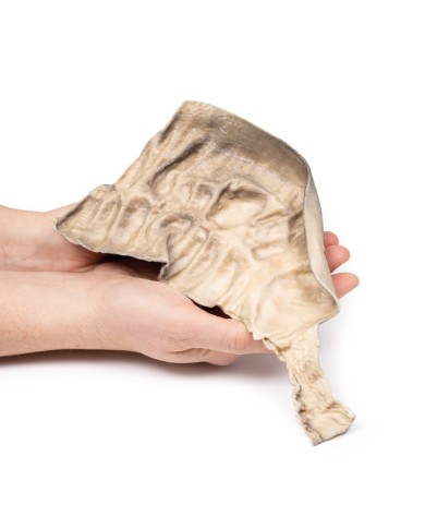 Malattia di Hirschsprung Erler Zimmer 3D anatomy Series MP2079