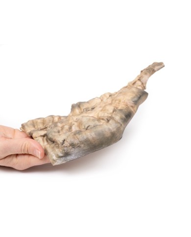 Malattia di Hirschsprung Erler Zimmer 3D anatomy Series MP2079