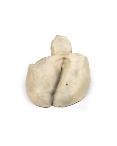 Colecistite e colelitiasi Erler Zimmer 3D anatomy Series MP2082