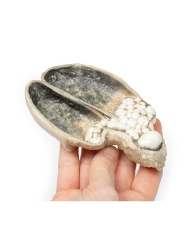 Colecistite e colelitiasi Erler Zimmer 3D anatomy Series MP2082