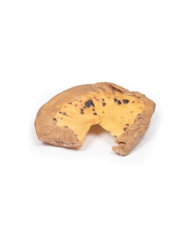 Metastasi mesenteriche da melanoma cutaneo maligno Erler Zimmer 3D anatom