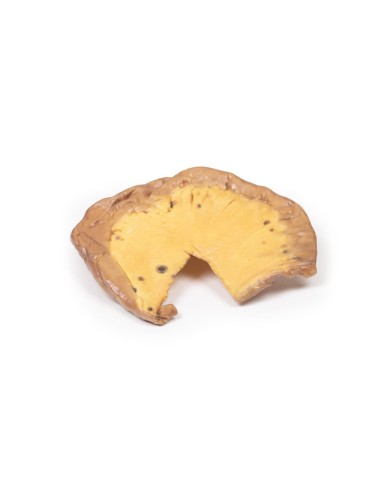 Metastasi mesenteriche da melanoma cutaneo maligno Erler Zimmer 3D anatom