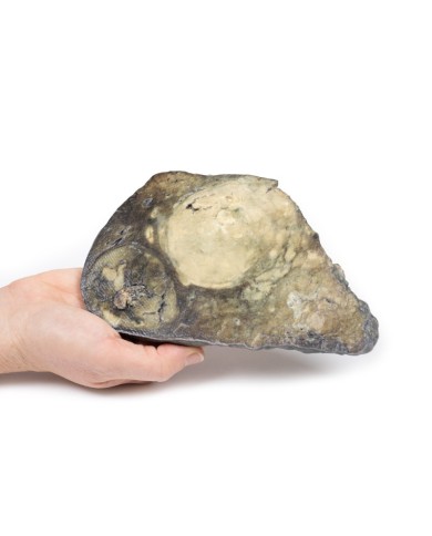 Carcinoma epatocellulare Erler Zimmer 3D anatomy Series MP2085