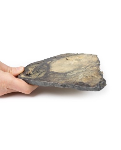 Carcinoma epatocellulare Erler Zimmer 3D anatomy Series MP2085