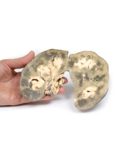 Rene a ferro di cavallo Erler Zimmer 3D anatomy Series MP2092