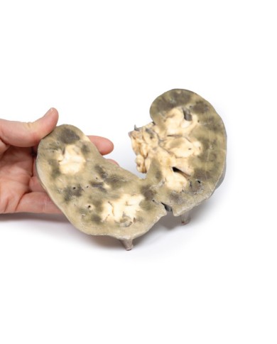 Rene a ferro di cavallo Erler Zimmer 3D anatomy Series MP2092