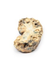 Malattia del rene policistico dell adulto Erler Zimmer 3D anatomy Series 